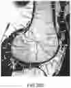 Fig. 72 - System and method for image segmentation, bone model generation and modification, and surgical planning