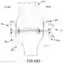Fig. 80 - System and method for image segmentation, bone model generation and modification, and surgical planning