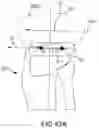 Fig. 86 - System and method for image segmentation, bone model generation and modification, and surgical planning
