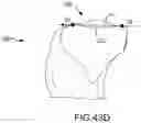 Fig. 89 - System and method for image segmentation, bone model generation and modification, and surgical planning