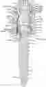 Fig. 01 - Pedicle screw assemblies with 3D printed components