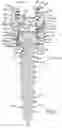 Fig. 04 - Pedicle screw assemblies with 3D printed components