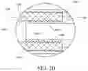 Fig. 04 - Sleeve for bone fixation device