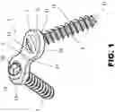 Fig. 02 - Internal plate fixation device