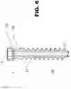 Fig. 07 - Internal plate fixation device