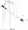 Fig. 32 - Hip or shoulder prosthesis and placement instruments