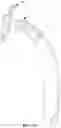 Fig. 41 - Hip or shoulder prosthesis and placement instruments