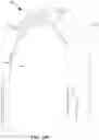 Fig. 48 - Hip or shoulder prosthesis and placement instruments