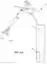 Fig. 69 - Hip or shoulder prosthesis and placement instruments