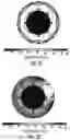 Fig. 06 - DEVICE AND METHOD FOR ELECTROPORATION BASED TREATMENT OF STENOSIS OF A TUBULAR BODY PART