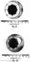 Fig. 07 - DEVICE AND METHOD FOR ELECTROPORATION BASED TREATMENT OF STENOSIS OF A TUBULAR BODY PART