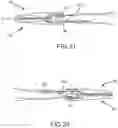 Fig. 22 - Electrosurgical Sealer and Divider