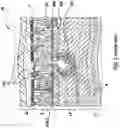 Fig. 03 - Methods, apparatuses, and systems for the treatment of pulmonary disorders