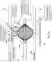 Fig. 19 - Methods, apparatuses, and systems for the treatment of pulmonary disorders