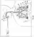 Fig. 22 - Methods, apparatuses, and systems for the treatment of pulmonary disorders