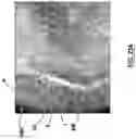 Fig. 23 - Methods, apparatuses, and systems for the treatment of pulmonary disorders