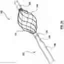 Fig. 25 - Methods, apparatuses, and systems for the treatment of pulmonary disorders