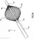 Fig. 27 - Methods, apparatuses, and systems for the treatment of pulmonary disorders