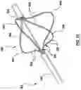 Fig. 31 - Methods, apparatuses, and systems for the treatment of pulmonary disorders