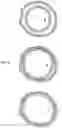 Fig. 10 - Method for determining the positioning in deployed position of an implantable medical device after expansion in a vascular structure
