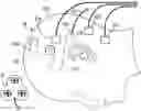 Fig. 01 - Cochlear implant localization system