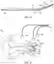 Fig. 06 - Cochlear implant localization system