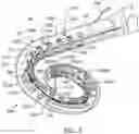 Fig. 09 - Cochlear implant localization system