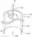 Fig. 01 - ILLUMINATED TELESCOPING CANNULA