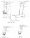 Fig. 08 - ILLUMINATED TELESCOPING CANNULA