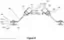 Fig. 06 - Abdominal closure method and device variations for closing ventral hernias and reducing recurrence