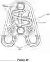 Fig. 22 - Abdominal closure method and device variations for closing ventral hernias and reducing recurrence