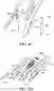 Fig. 15 - Adjustable endolumenal implant for reshaping the mitral valve annulus
