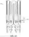 Fig. 16 - Adjustable endolumenal implant for reshaping the mitral valve annulus