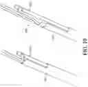 Fig. 27 - Adjustable endolumenal implant for reshaping the mitral valve annulus