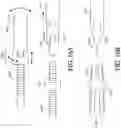 Fig. 33 - Adjustable endolumenal implant for reshaping the mitral valve annulus