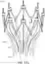 Fig. 40 - Adjustable endolumenal implant for reshaping the mitral valve annulus