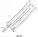 Fig. 48 - Adjustable endolumenal implant for reshaping the mitral valve annulus