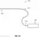 Fig. 02 - SYSTEMS, DEVICES, AND METHODS FOR EXPANDING THE DIAMETER OF THE PROSTATIC URETHRA