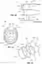 Fig. 03 - SYSTEMS, DEVICES, AND METHODS FOR EXPANDING THE DIAMETER OF THE PROSTATIC URETHRA