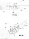 Fig. 07 - SYSTEMS, DEVICES, AND METHODS FOR EXPANDING THE DIAMETER OF THE PROSTATIC URETHRA