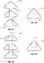 Fig. 16 - SYSTEMS, DEVICES, AND METHODS FOR EXPANDING THE DIAMETER OF THE PROSTATIC URETHRA