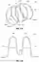 Fig. 32 - SYSTEMS, DEVICES, AND METHODS FOR EXPANDING THE DIAMETER OF THE PROSTATIC URETHRA