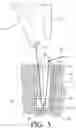 Fig. 06 - Intraosseous screw with cortical window and system and method for associating soft tissue with bone