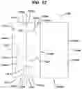 Fig. 17 - Implant and filament management device