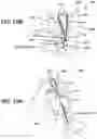 Fig. 26 - Implant and filament management device