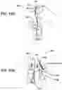 Fig. 28 - Implant and filament management device