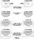 Fig. 03 - Breast implants with integrated transponders
