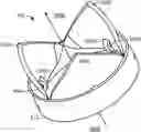 Fig. 01 - Trileaflet mechanical prosthetic heart valve