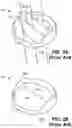 Fig. 03 - Trileaflet mechanical prosthetic heart valve