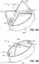 Fig. 04 - Trileaflet mechanical prosthetic heart valve